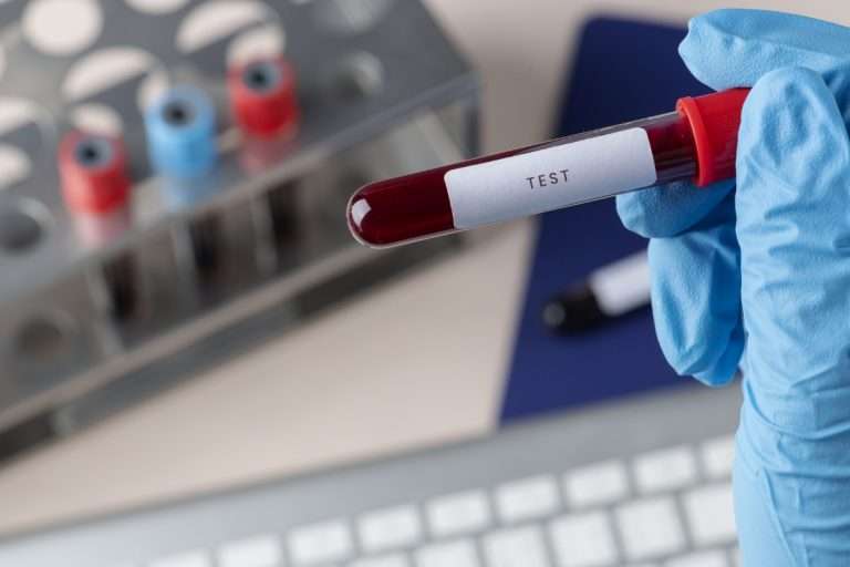 quanto dura il cbd nelle urine